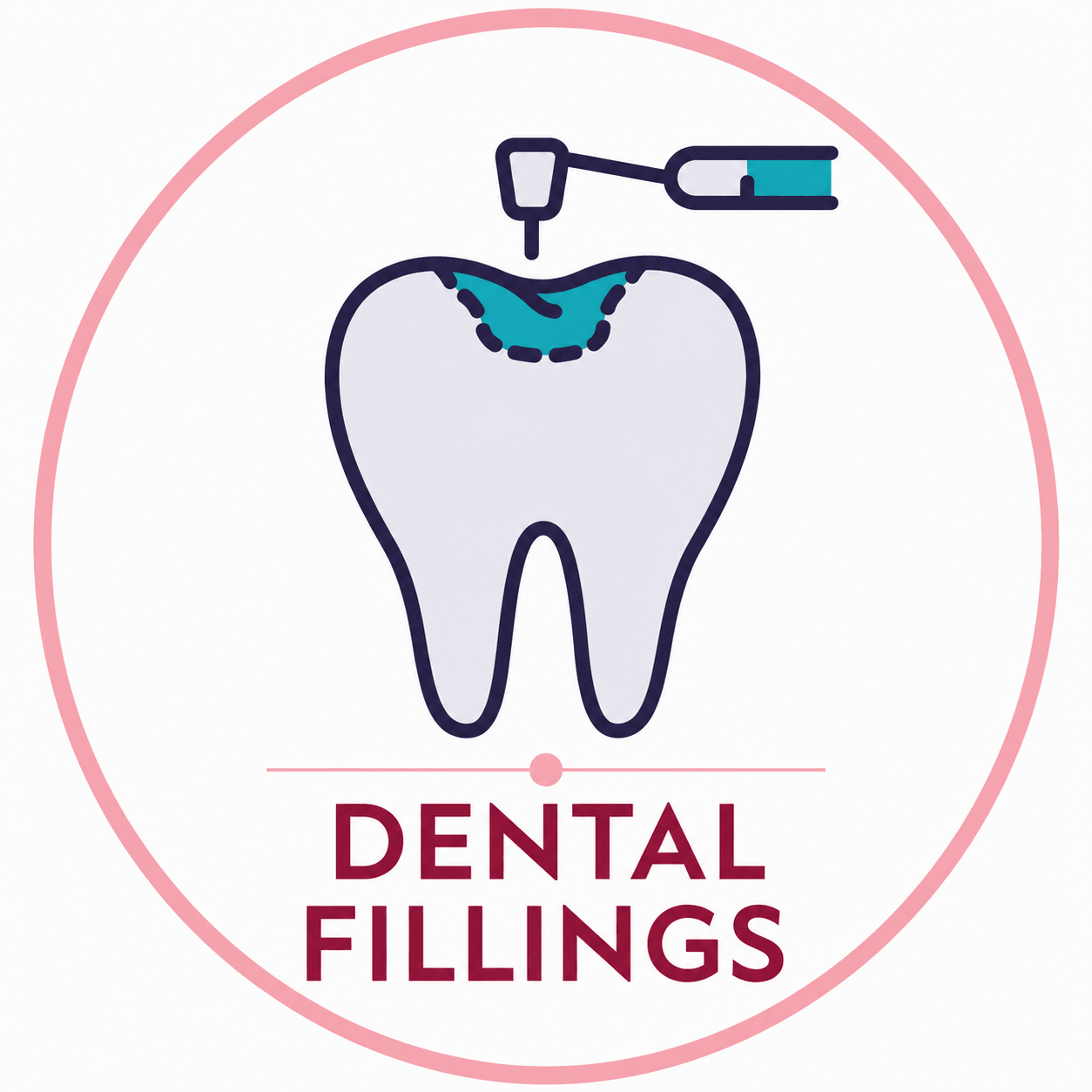 Dental Fillings