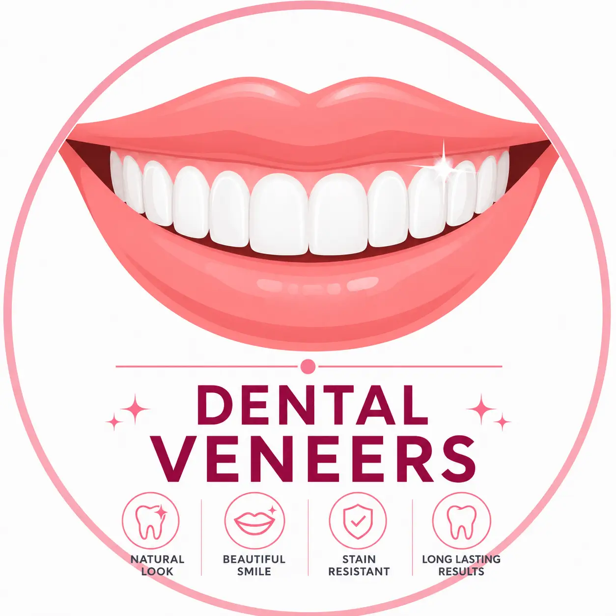 Dental Veneers