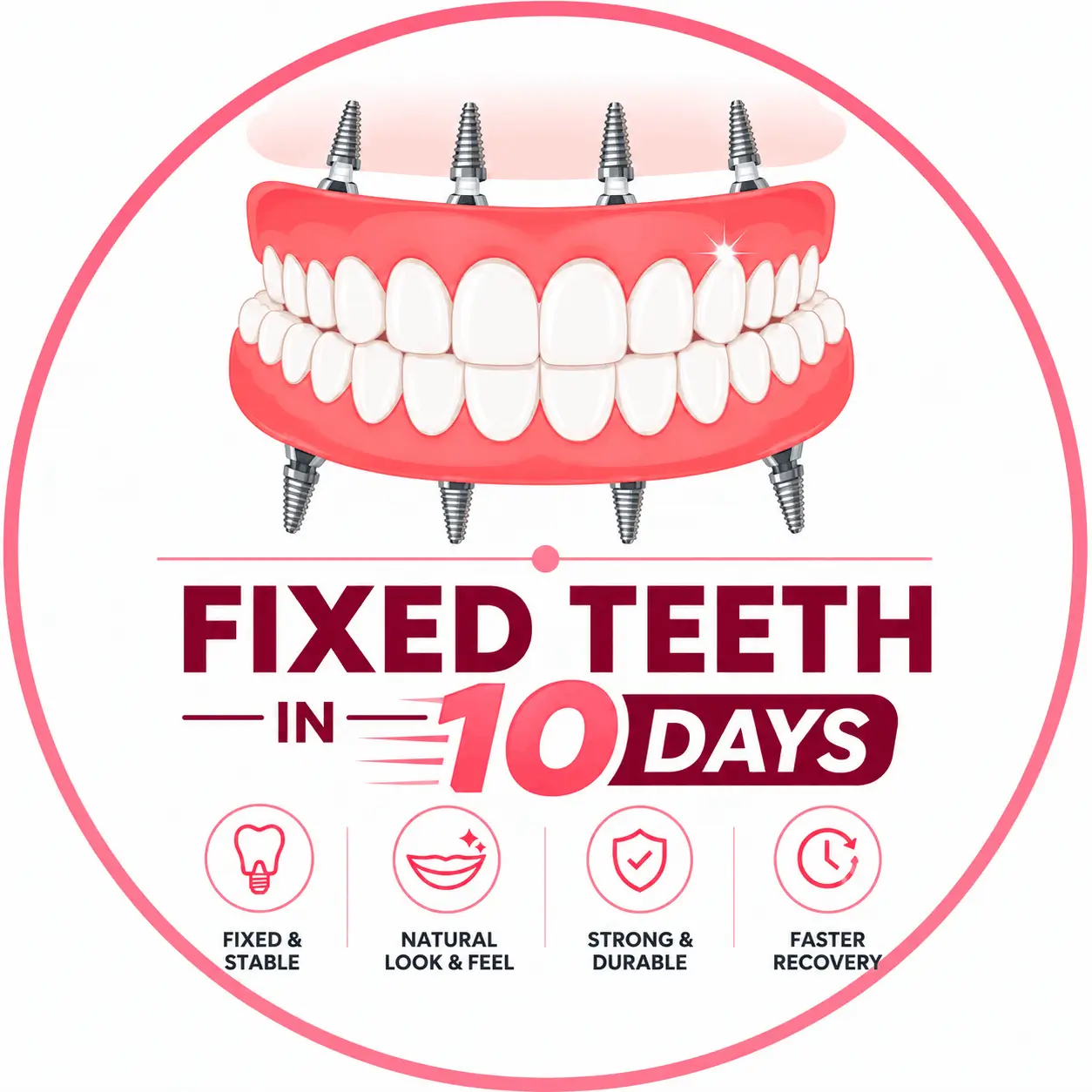Fixed Teeth in 10 Days
