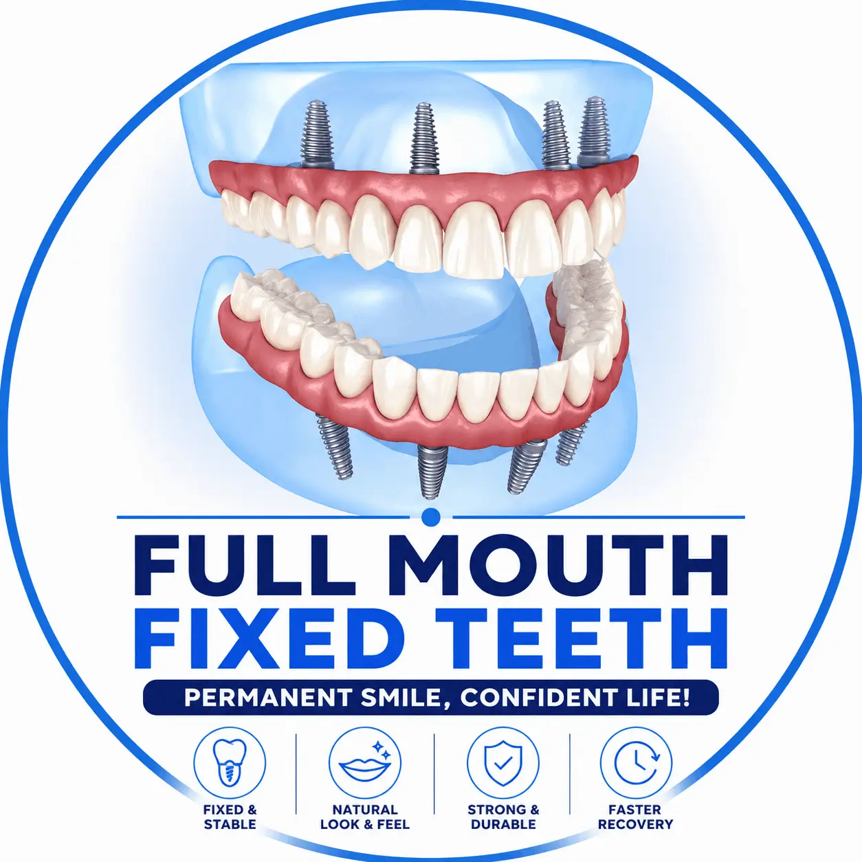 Full-Mouth Fixed Teeth