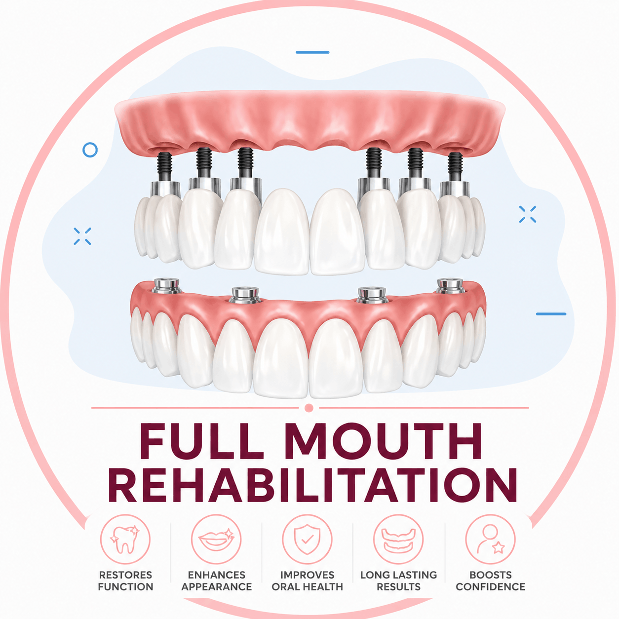 Full-Mouth Rehabilitation