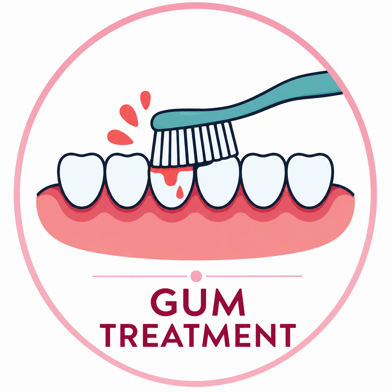 Gum Treatment