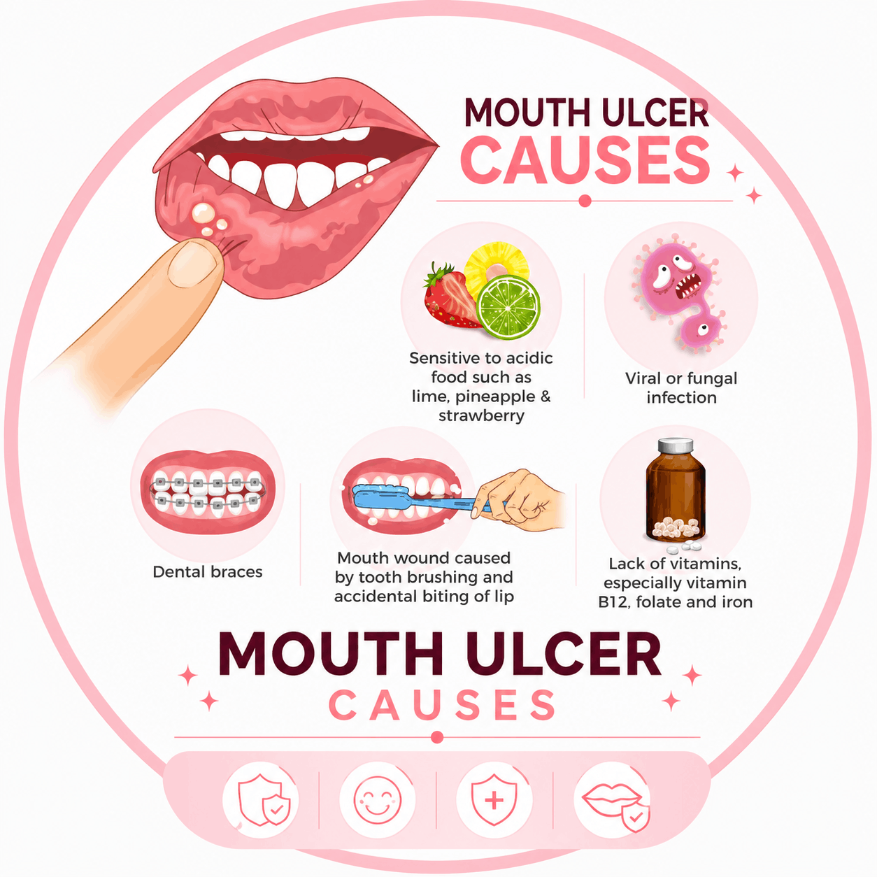 Mouth Ulcers