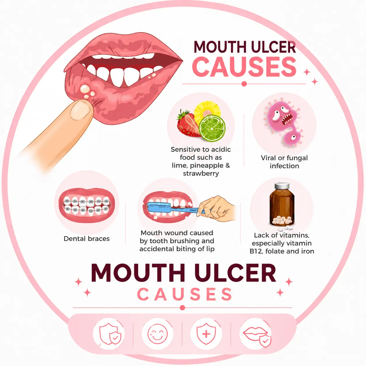Mouth Ulcers