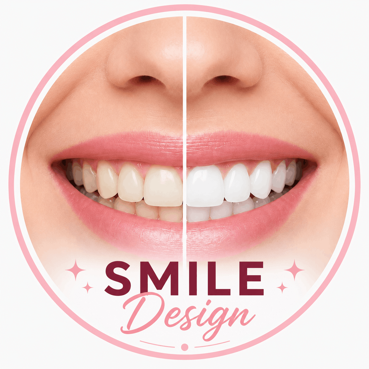 Smile Makeover & Cosmetic