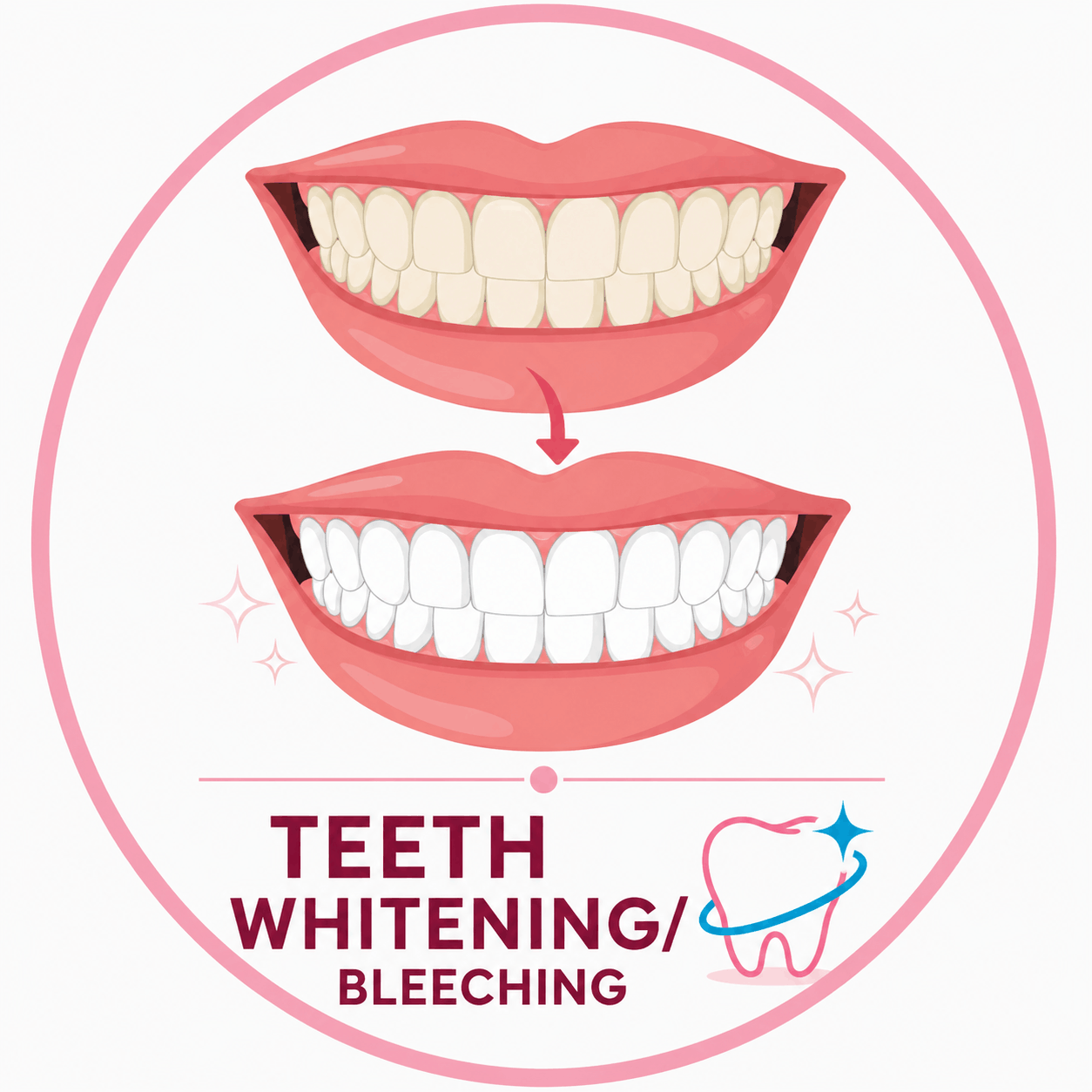 Teeth Whitening