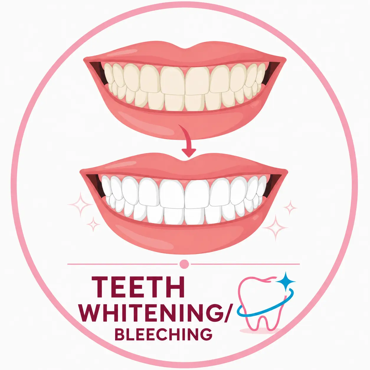 Teeth Whitening