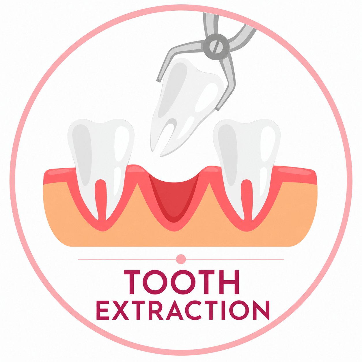Tooth Extraction