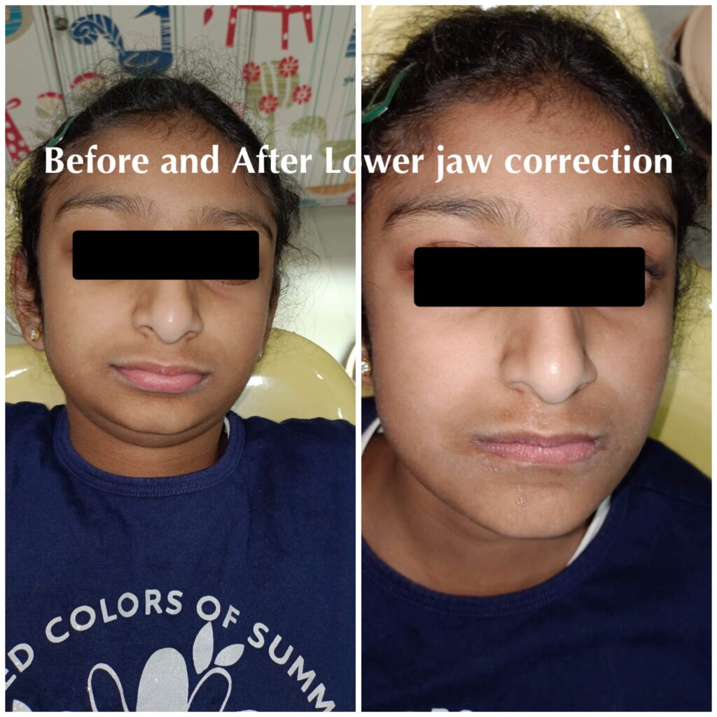 before-after