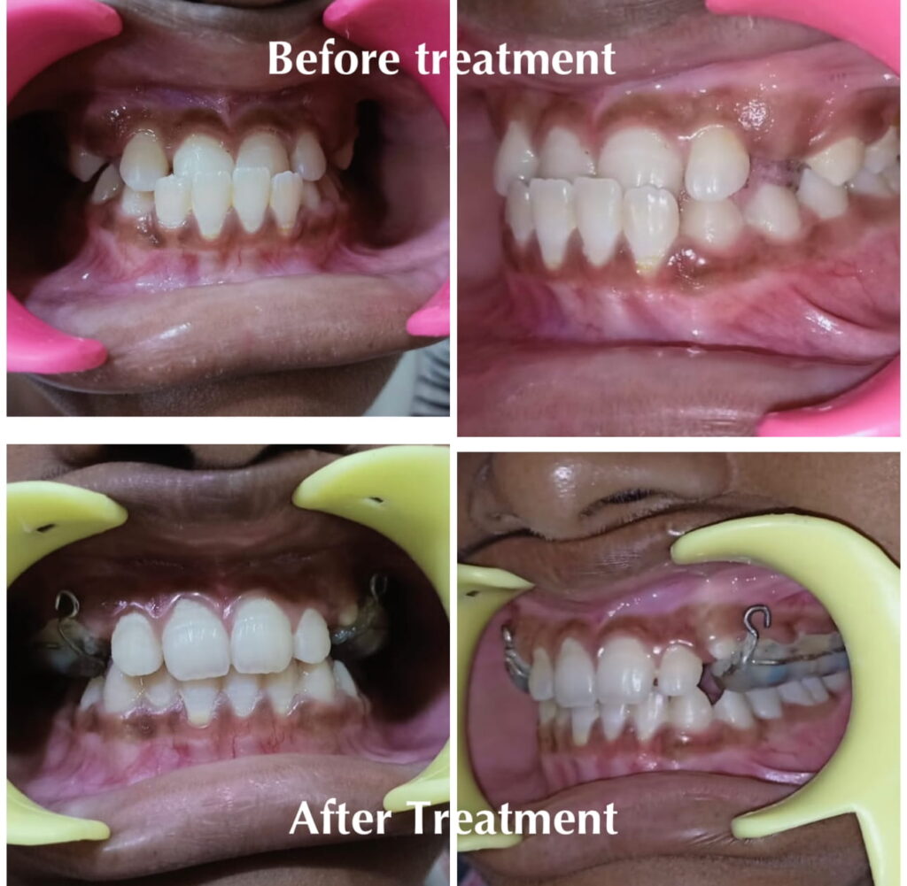 before-after-2