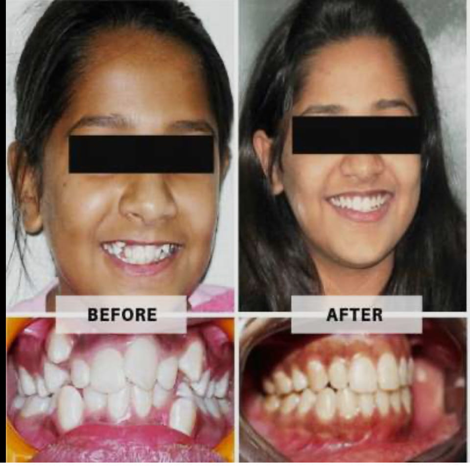 before-after-3