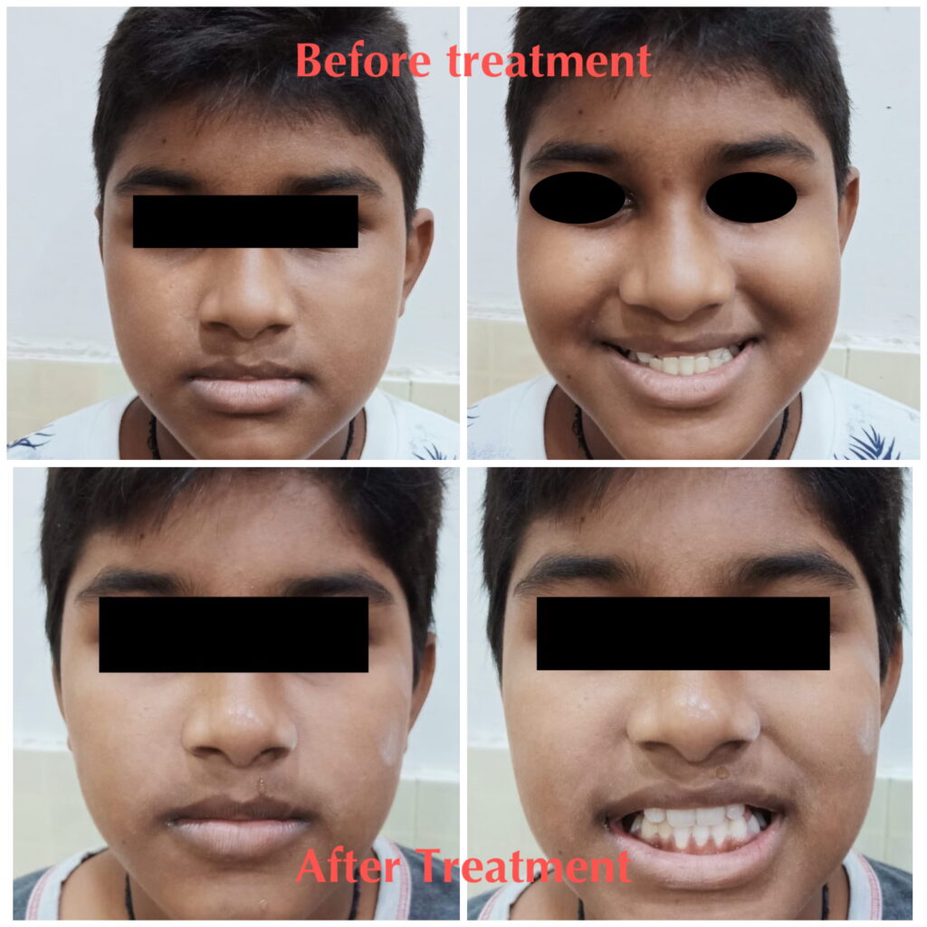 before-after-4