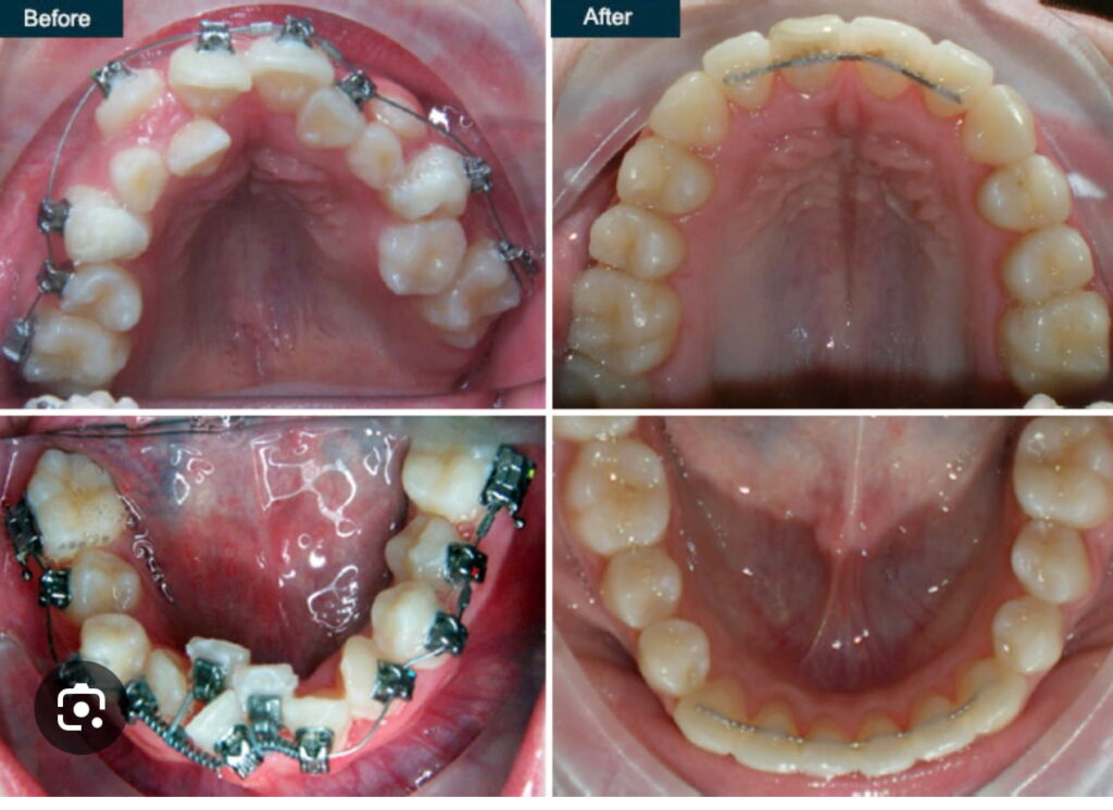 before-after-5