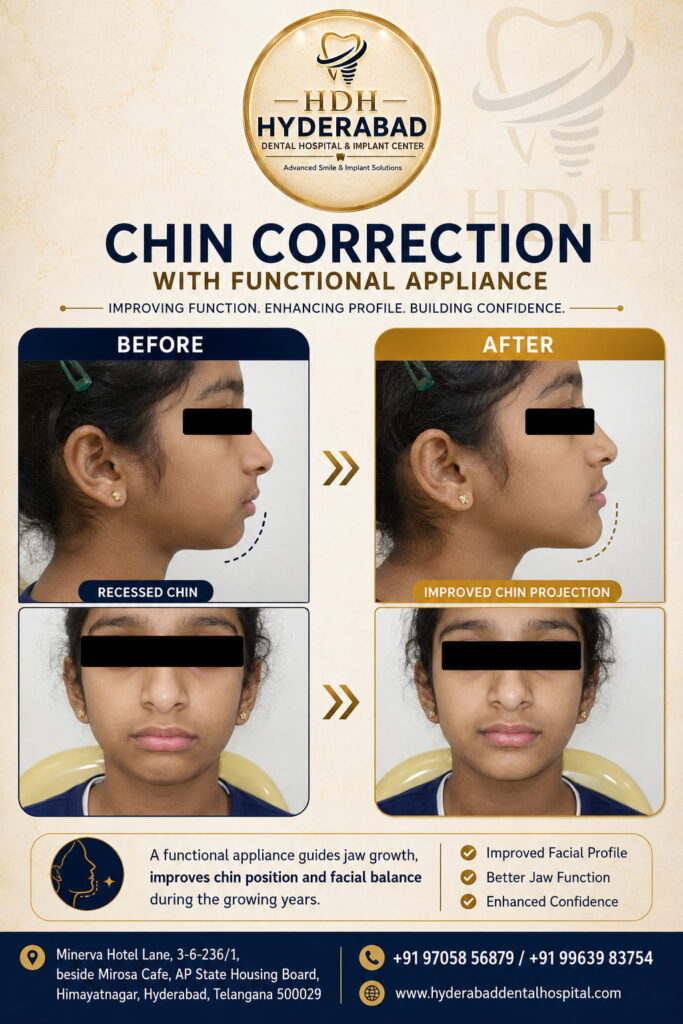 chin-correction