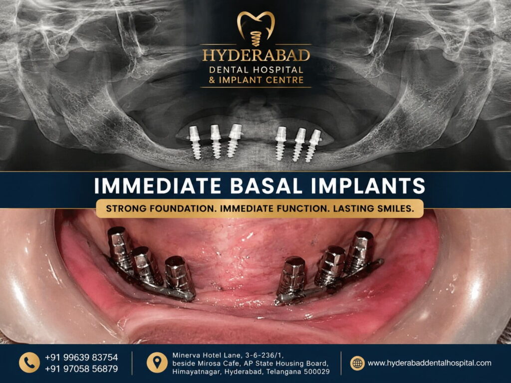 dental-implant-2