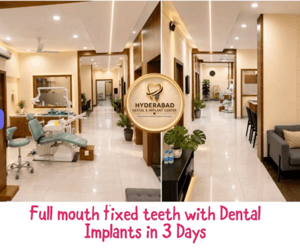 Full mouth fixed teeth with Dental Implants in 3 Days
