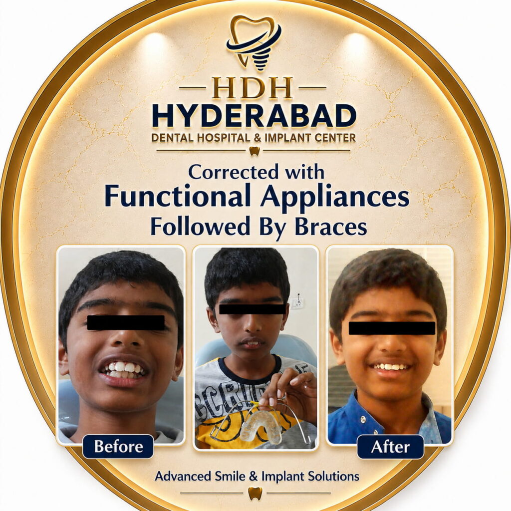 functional-appliances