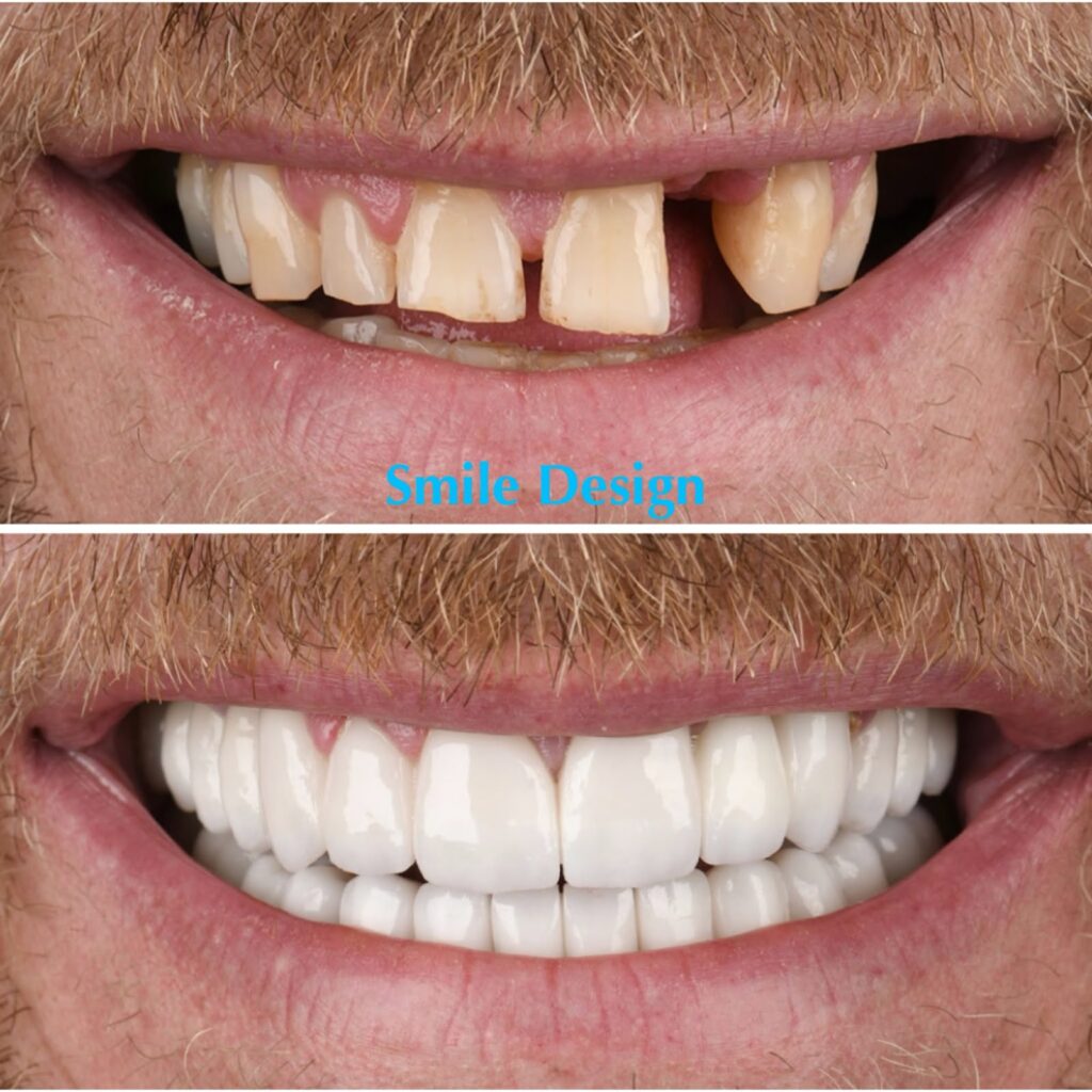 smile-makeover-1
