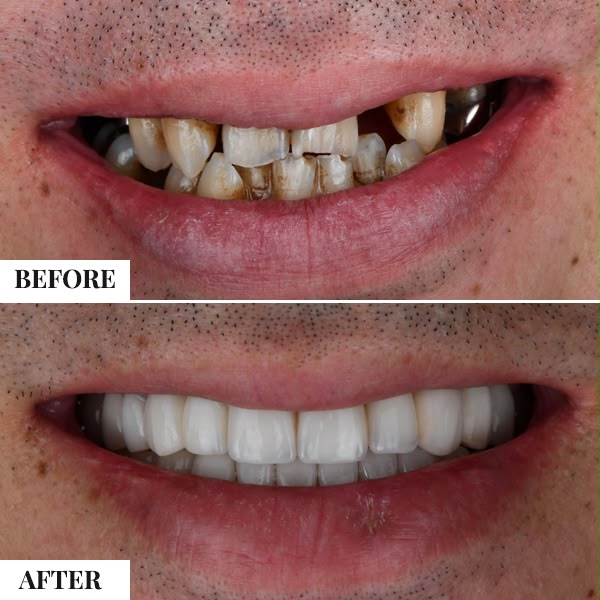 smile-makeover-10
