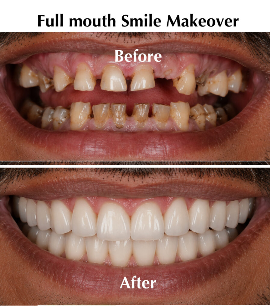 smile-makeover-12