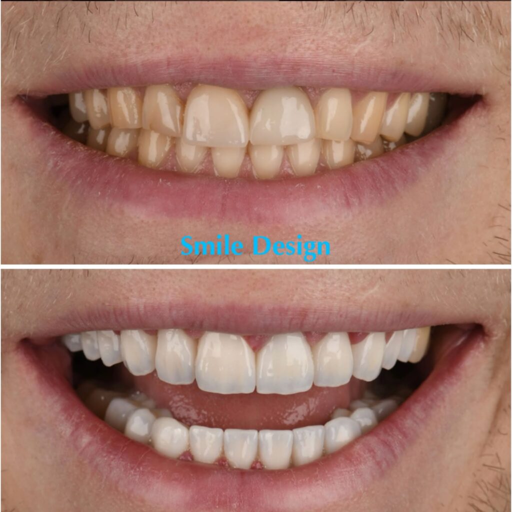 smile-makeover-13