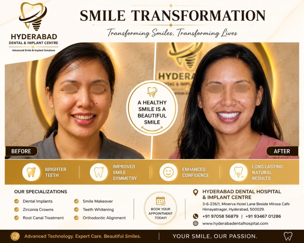 smile-makeover-14