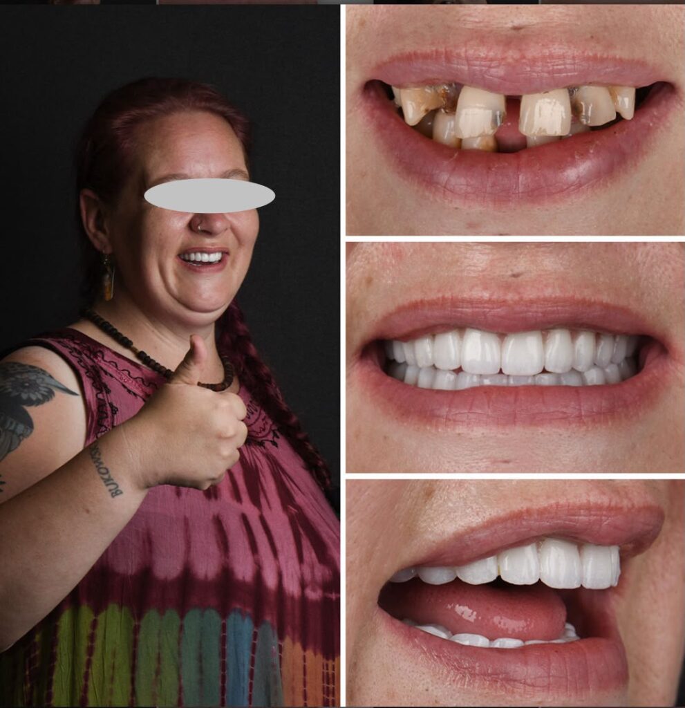 smile-makeover-15