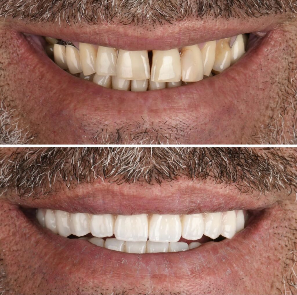 smile-makeover-2