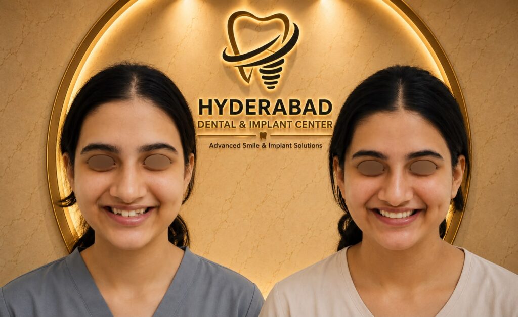 smile-makeover-4