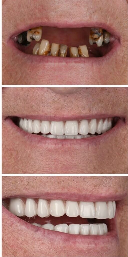 smile-makeover-5