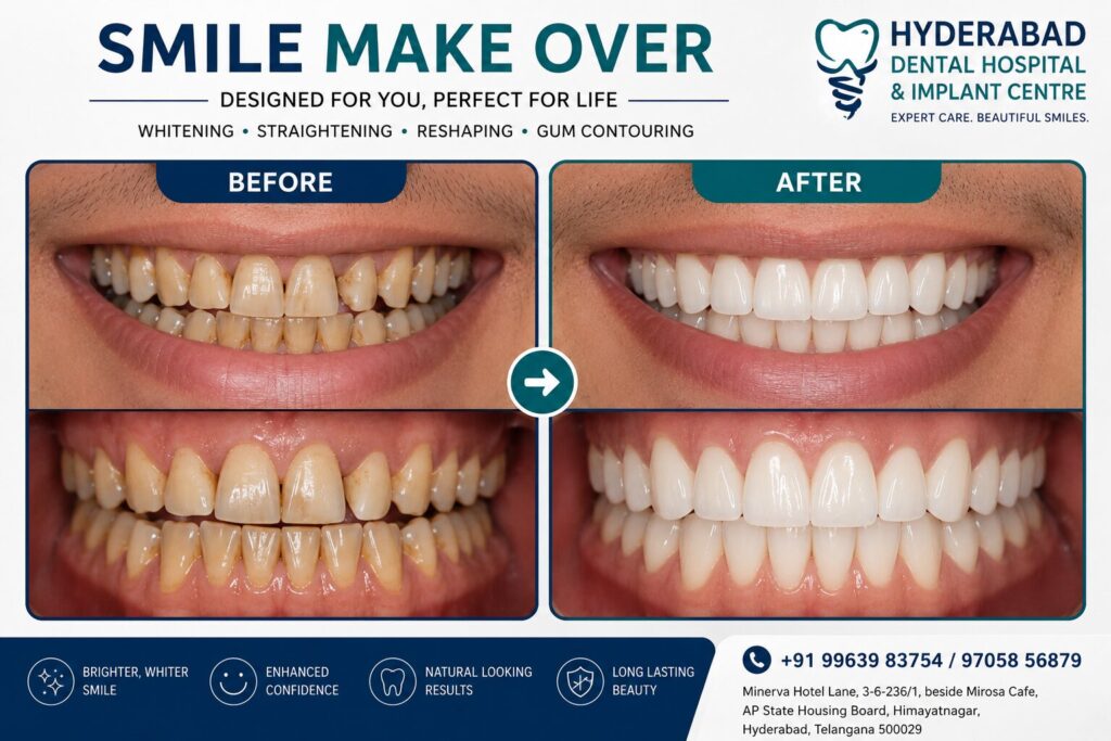 smile-makeover-6