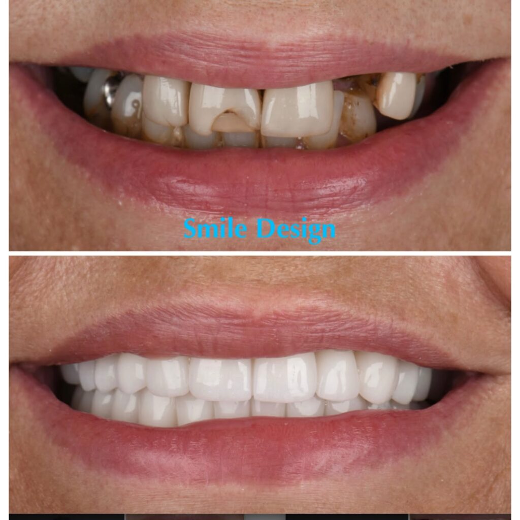 smile-makeover-7